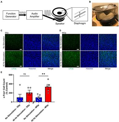 Vibrotactile stimulation at gamma frequency mitigates pathology related to neurodegeneration and improves motor function